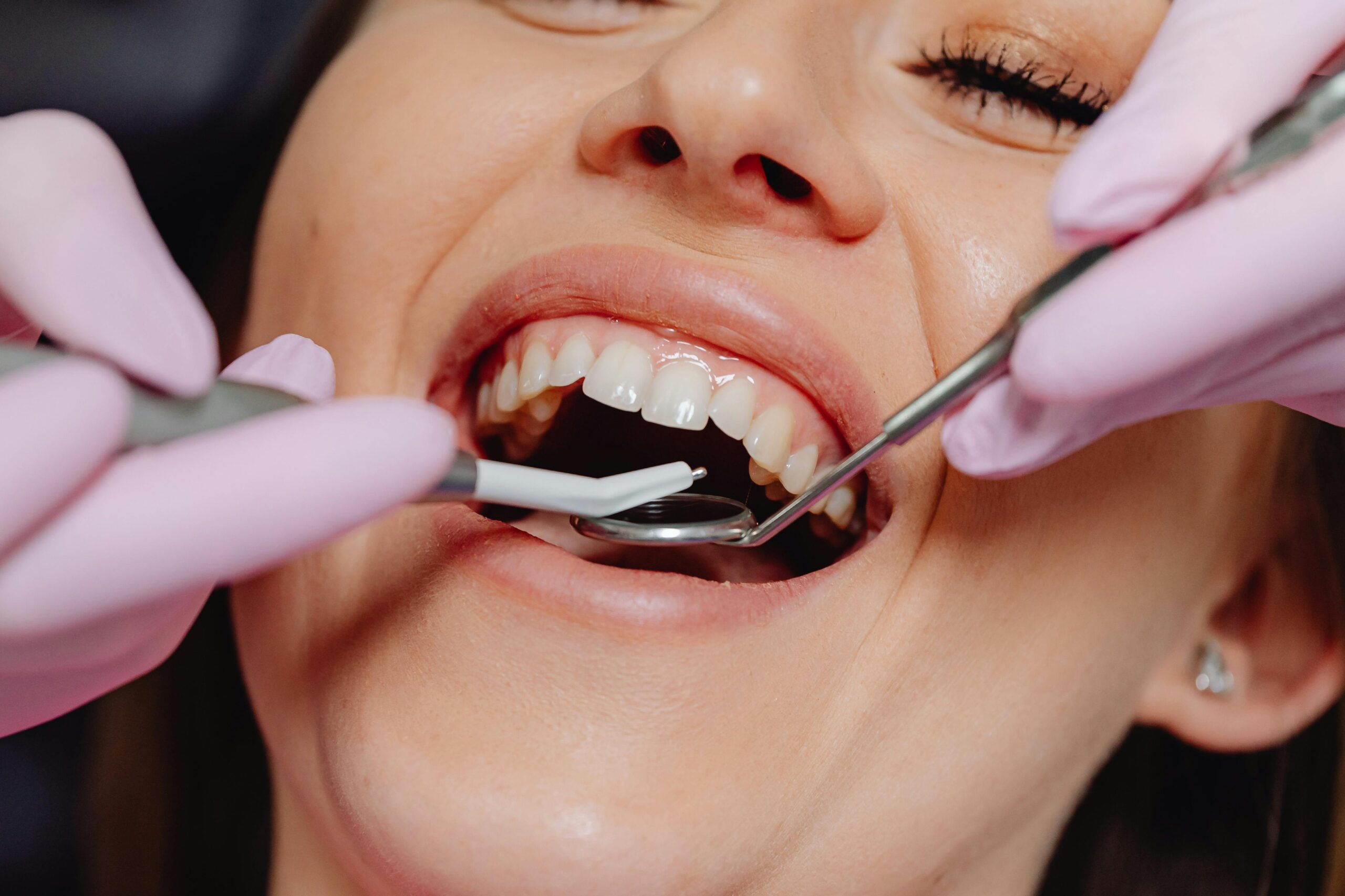 Servicios periodoncia realizada por profesionales